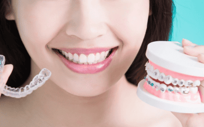 Invisalign vs braces which one is the best way to Straighten Teeth