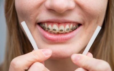 What is dental Wax for Braces and How to use it?