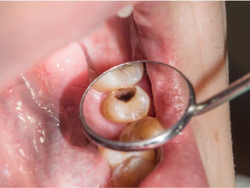 tooth pain emergency