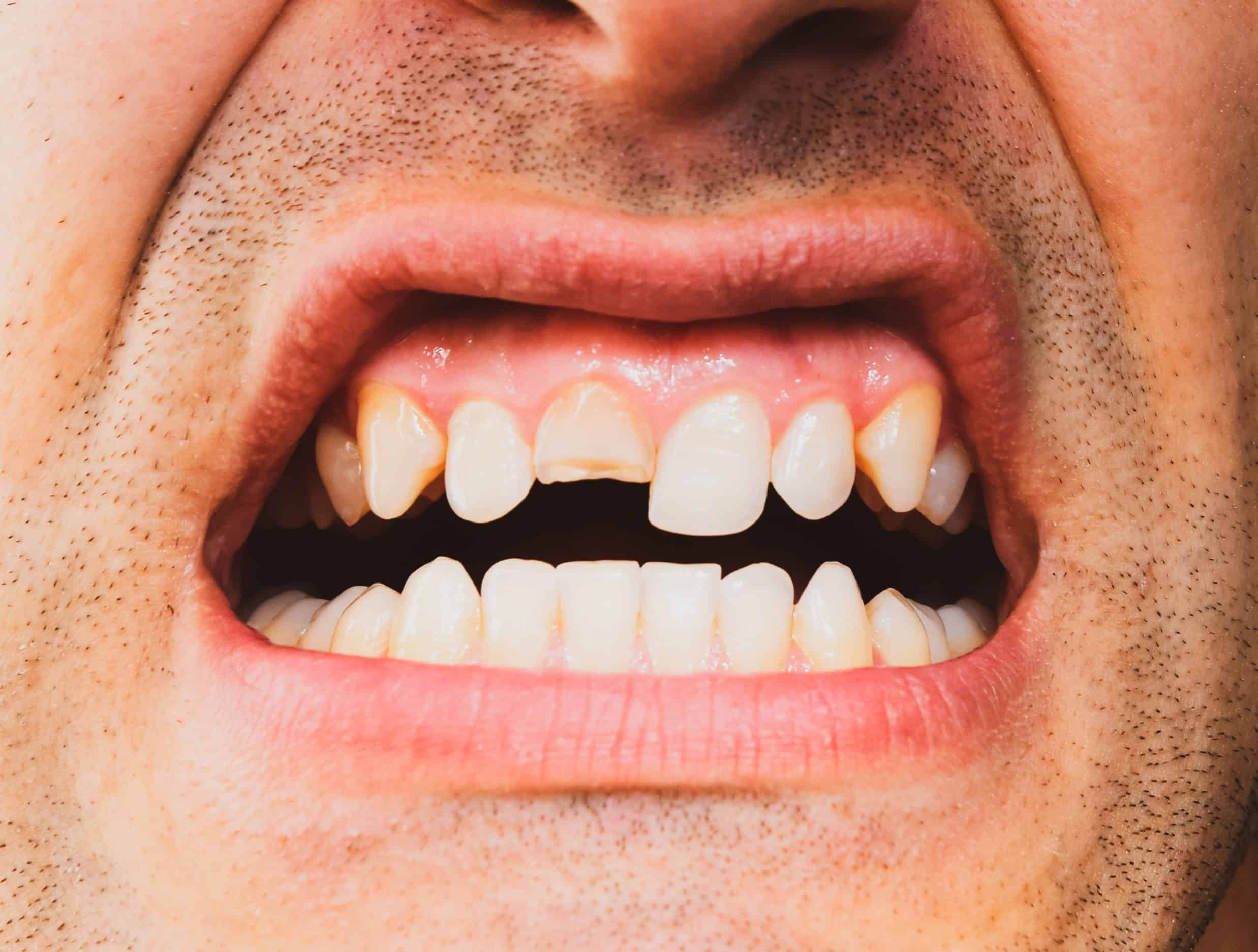 tooth pain emergency