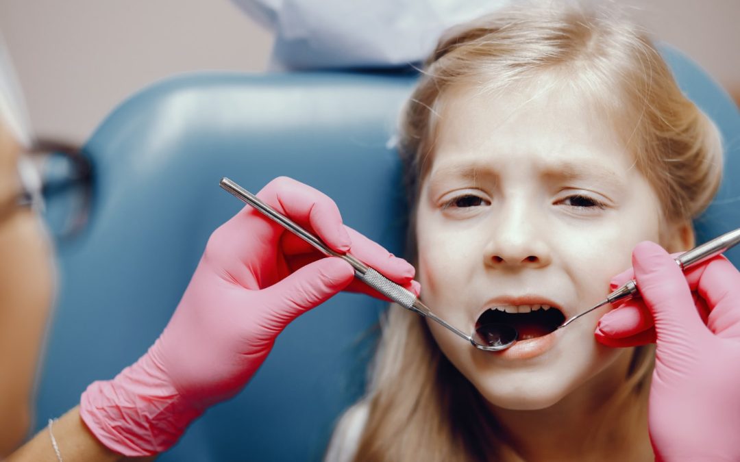 dental sealants for kids