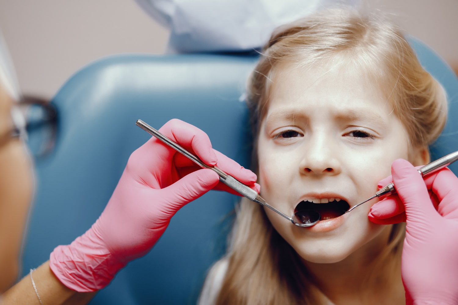dental sealants for kids