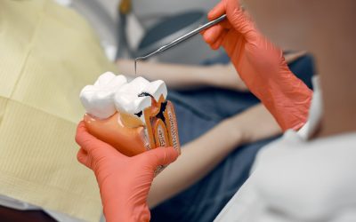 How long Do Dental Crowns Last? Realistic Expectations & How to Extend Life