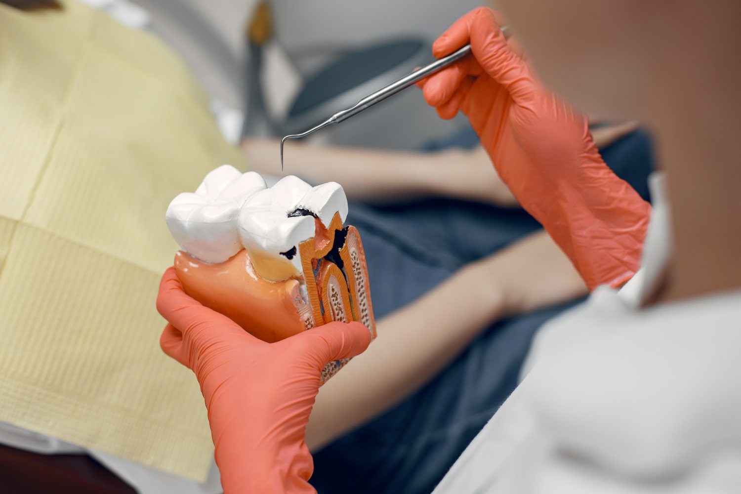 How long Do Dental Crowns Last
