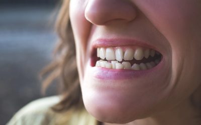 Invisalign vs Braces vs Veneers: Which is Best for Crooked Teeth?