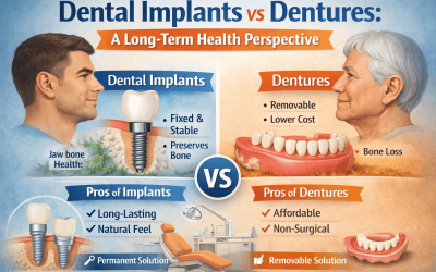 Dental Implants vs Dentures: A Long-Term Health Perspective